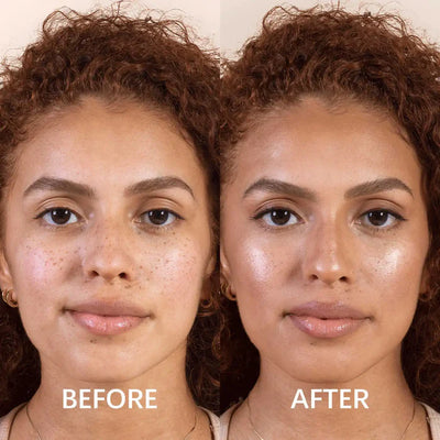 Allura™ Eye Spa Kit With Red Light Therapy