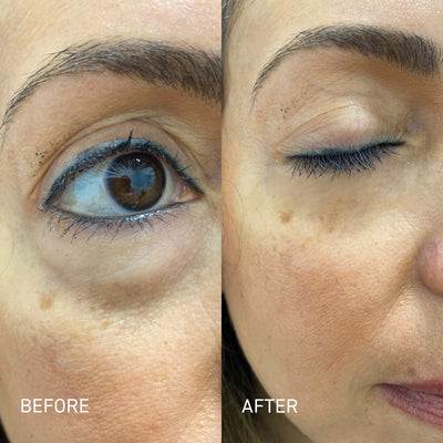 Allura™ Eye Spa Kit With Red Light Therapy