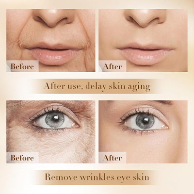 Allura™ Eye Spa Kit With Red Light Therapy