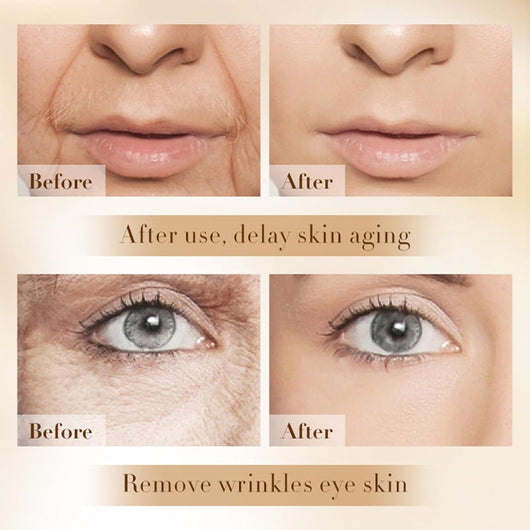 Allura™ Eye Spa Kit With Red Light Therapy