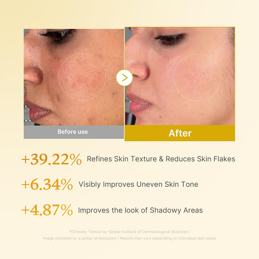 Medicube Kojic Turmeric Toner