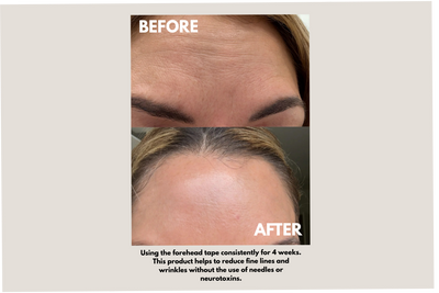 Smoothskin™ Overnight Patches